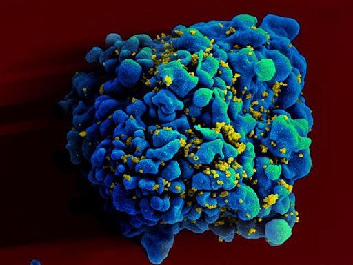 'Sweet Tooth' May Be 'Achilles Heel' of HIV