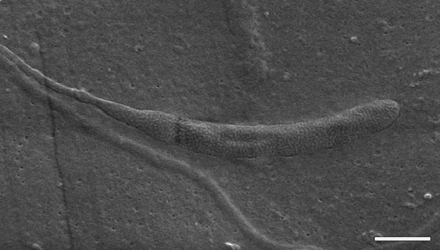 Surprise Find in Antarctica: Oldest Animal Sperm