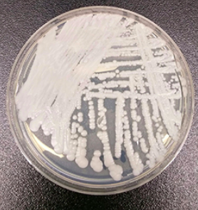 Feared US Outbreak of Fatal Fungus Confirmed: CDC