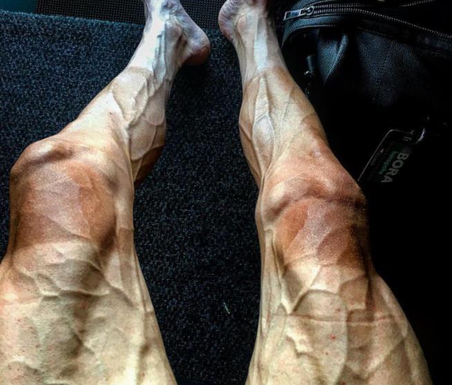 'Freaky' Photo Shows Physical Toll of Tour de France