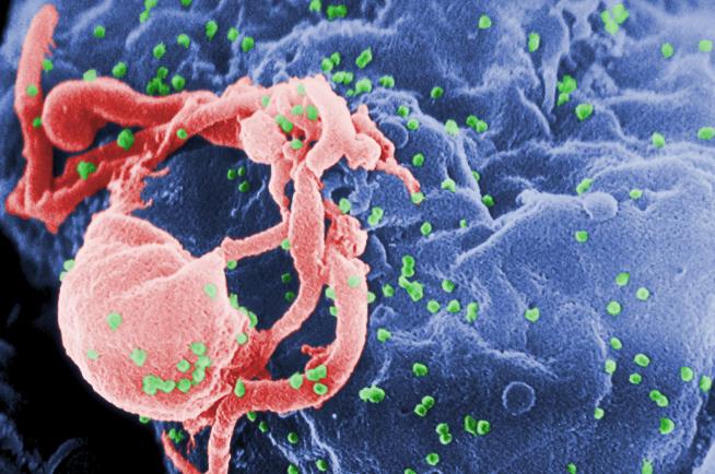 After 8 Years With No Drugs, Girl's HIV Still Under Control
