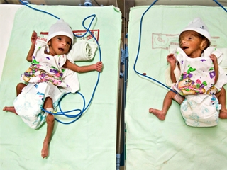 Twins Born to 70-Year-Old