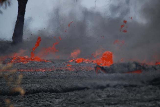 Man Hit by Lava Bomb: 'It's Just Been Amazing'