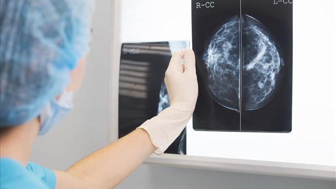 Thanks to FDA, Women Will Be Told of Their Breast Density