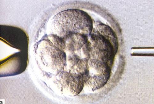 UK Weighs Revolution in IVF Rules