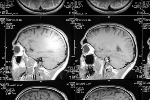 Scientists Read Subjects' Location From Brain Scans