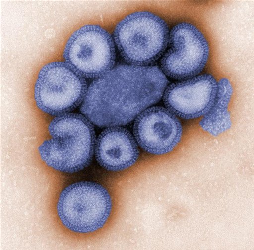 H1N1 Expands, Kills Costa Rica Man