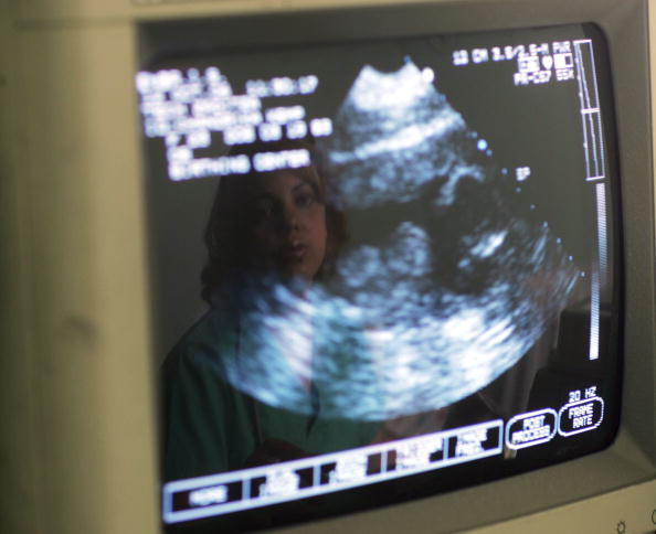 Judge Terminates Ultrasound Abortion Law