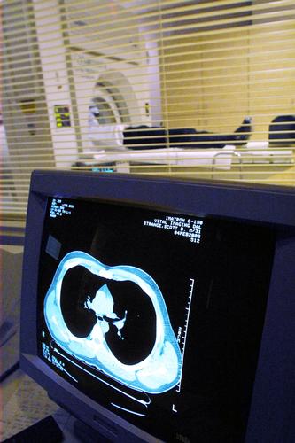 Lung Scans Fail To Cut Deaths