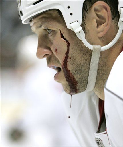 Ice Hockey Linked to Brain Damage