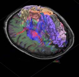 Scientists Unveil 'Brain Atlas'