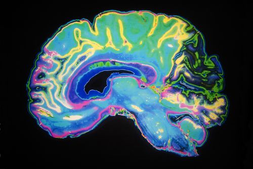 Brain Scans of Addicts' Siblings Offer a Clue