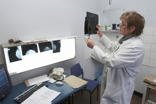 As Mammograms Go Digital, Docs Call More Women Back