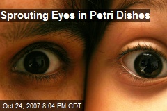 Sprouting Eyes in Petri Dishes