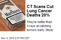 CT Scans Cut Lung Cancer Deaths 20%