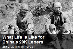 What Life Is Like for China's 20K Lepers