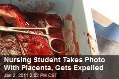 Nursing Student Takes Photo With Placenta, Gets Expelled