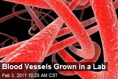 Blood Vessels Grown in a Lab