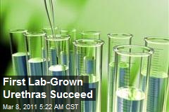 First Lab-Grown Urethras Succeed