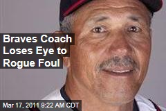 Atlanta Braves Minor League Manager Luis Salazar Loses Eye to Rogue Foul Ball