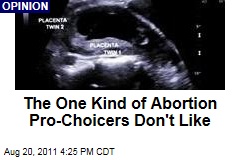 William Saletan: Why Pro-Choicers Don't Like Selective Twin Reduction Abortions