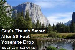 Guy&#39;s Thumb Saved After 80-Foot Yosemite Drop