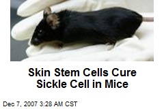 Skin Stem Cells Cure Sickle Cell in Mice