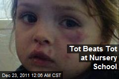 Tot Beats Tot at Nusery School