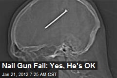 Nail Gun Fail: Yes, He&#39;s OK