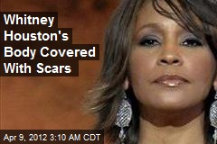 Whitney Houston&#39;s Body Covered With Scars