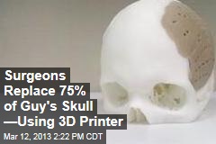 Surgeons Replace 75% of Guy&#39;s Skull &mdash;Using 3D Printer