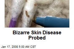 Bizarre Skin Disease Probed