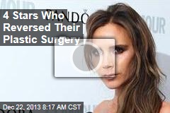 4 Stars Who Reversed Their Plastic Surgery