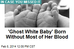 &#39;Ghost White Baby&#39; Born Without Most of Her Blood