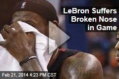 LeBron Suffers Broken Nose in Game