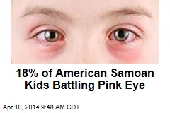 18% of American Samoan Kids Battling Pink Eye
