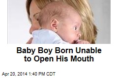Baby Boy Born Unable to Open His Mouth