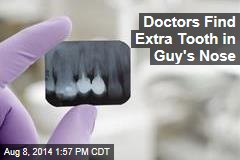 Doctors Find Extra Tooth in Really Odd Place