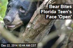 Bear Bites Florida Teen&#39;s &#39;Face Open&#39;