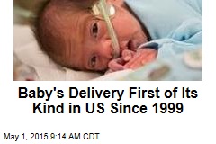 Baby&#39;s Delivery First of Its Kind in US Since 1999