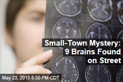 Small-Town Mystery: 9 Brains Found on Street