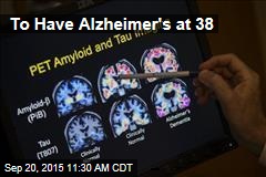 To Have Alzheimer&#39;s at 38