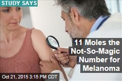 11 Moles the Not-So-Magic Number for Melanoma