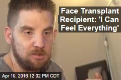 Face Transplant Recipient: &#39;I Can Feel Everything&#39;
