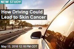 How Driving Could Lead to Skin Cancer