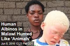 Human Albinos in Malawi Hunted Like &#39;Animals&#39;