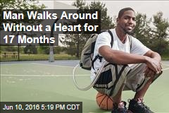 Man Walks Around Without a Heart for 17 Months