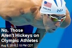 No, Those Aren&#39;t Hickeys on Olympic Athletes