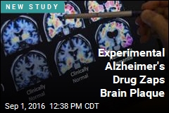 Experimental Alzheimer&#39;s Drug Zaps Brain Plaque