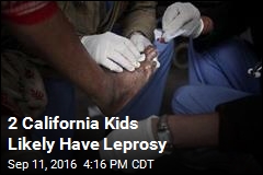 2 California Kids Likely Have Leprosy